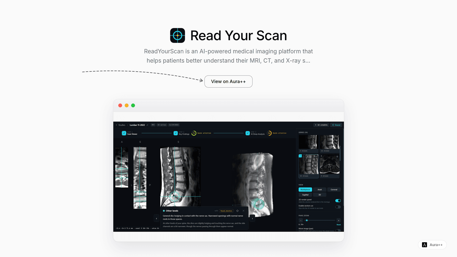 Understanding Radiology Reports: How ReadYourScan Simplifies It